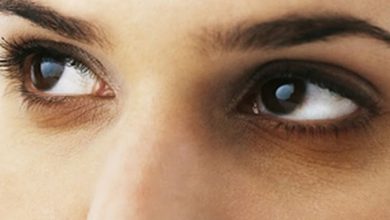 Dark Circles Are you troubled by the problem of dark circles under the eyes So adopt these home remedies, you will get relief soon