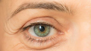 Puffy Eyes Home Remedies If you are also troubled by swelling of the eyes So follow these home remedies, you will get benefits