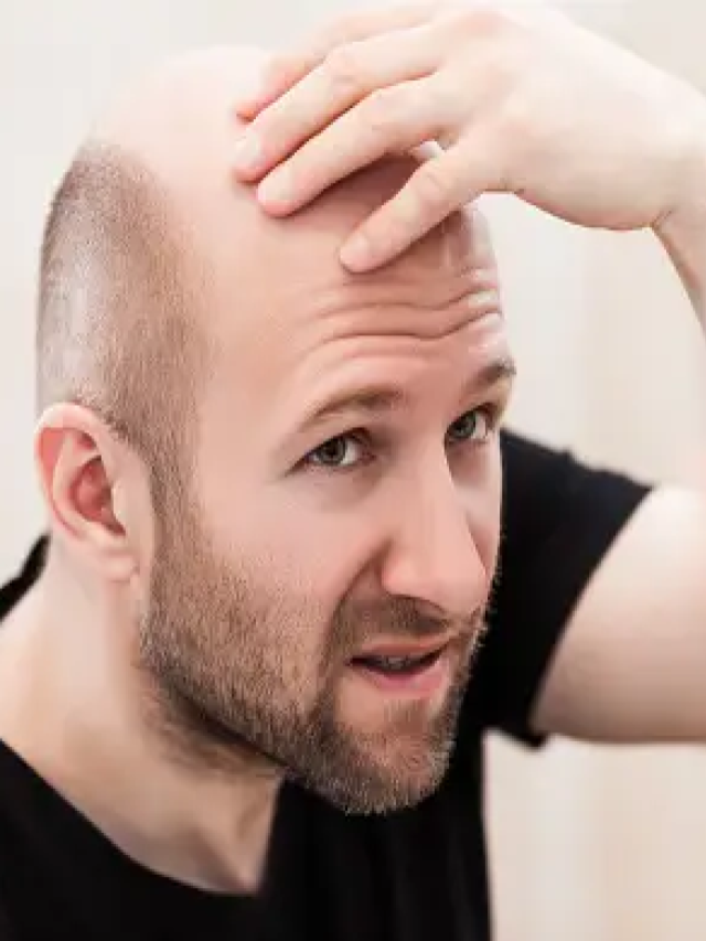 Are you ashamed of being bald? Apply this thing...hair will grow!