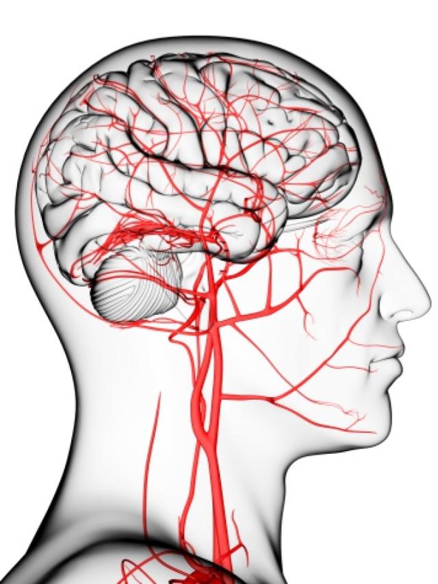 Brain Stroke: मस्तिष्क की क्षति को रोकने के लिए ऐसे करें ब्रेन स्ट्रोक की पहचान